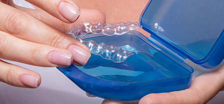 How should a mouth guard fit?