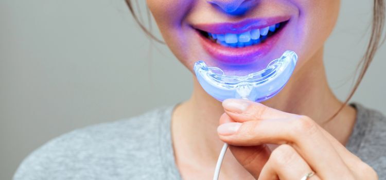 A Young Woman Is Engaged in Home Teeth Whitening. Complex for Teeth Whitening with UV Lamp