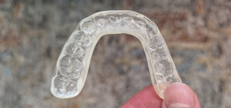 white calcium buildup on night guard