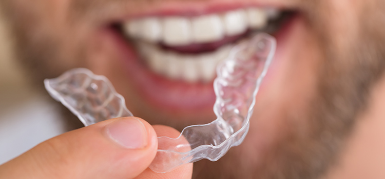 can a mouth guard shift your teeth