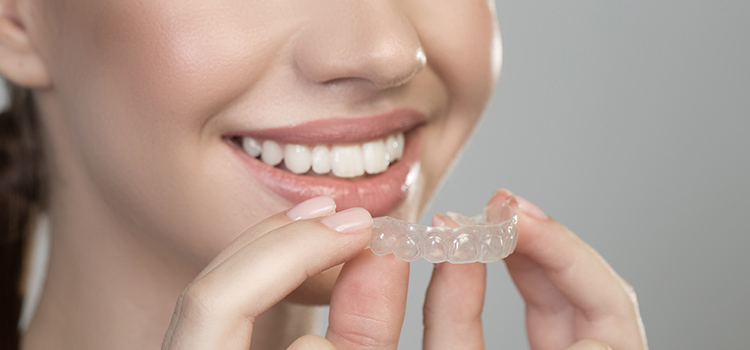 dental mouthguard