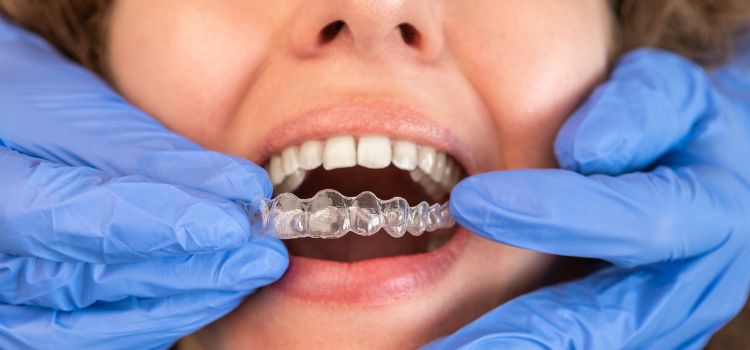 Dental professional wearing gloves fitting a clear retainer onto a patient’s upper teeth after orthodontic treatment.