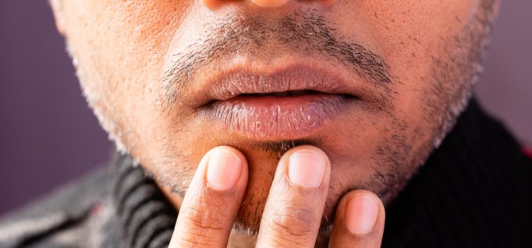Man with dry, cracked lips touching his mouth — a common sign of dry mouth from night guard use.