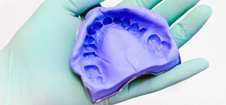 Dental impression of upper teeth held by a gloved hand