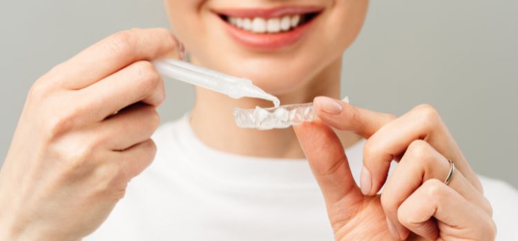 Woman applying whitening gel into a clear whitening tray