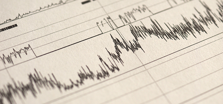 polysomnography