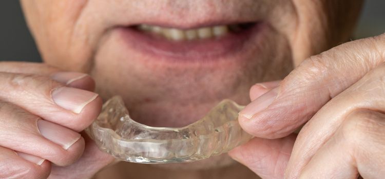 Senior man holding and placing a clear night guard over his lower teeth to manage teeth grinding.