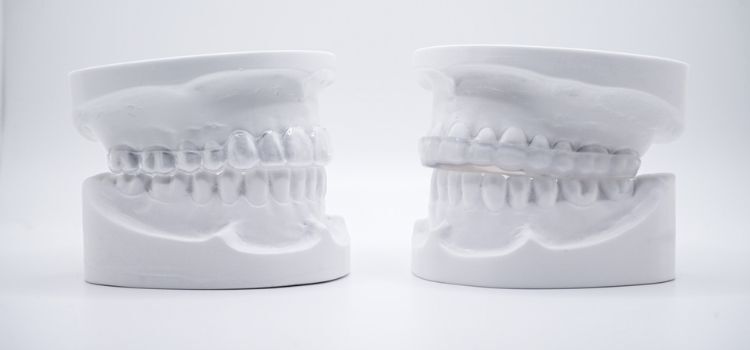 Side-by-side dental models showing a clear retainer on the left and a thicker night guard on the right to highlight key differences.