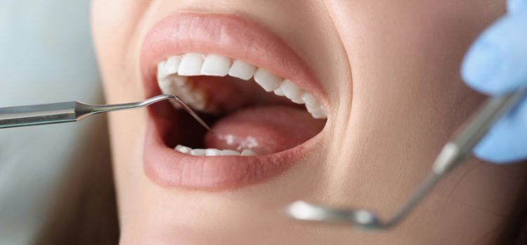 Signs You May Be Losing Enamel Signs You May Be Losing Enamel