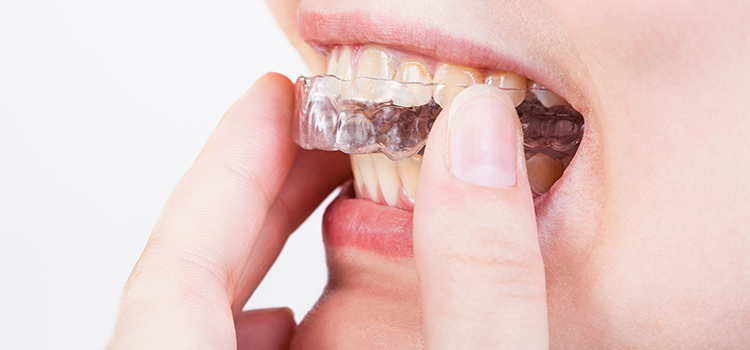 stop teeth grinding