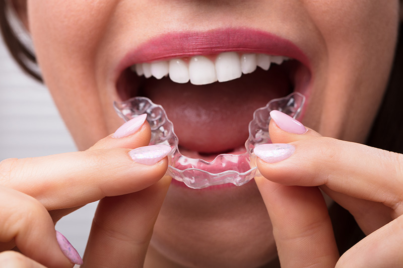 treatment of teeth clenching