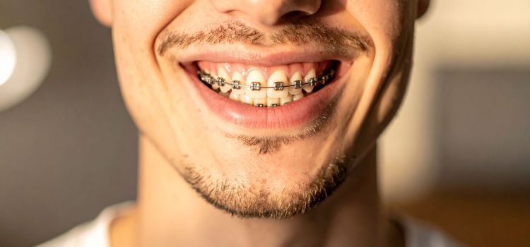 Treatment Options for Tooth Gaps