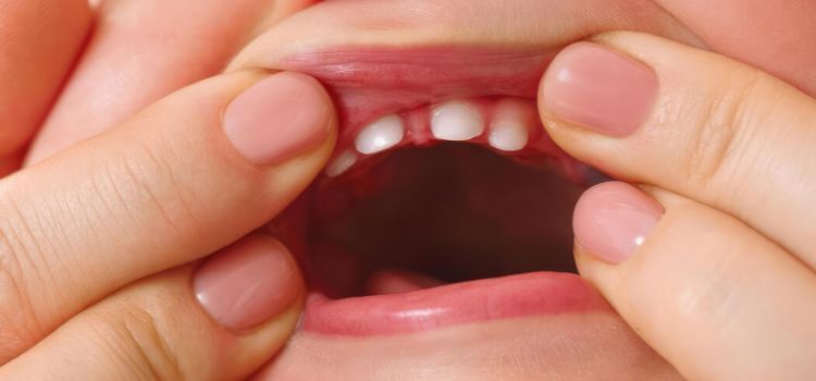 Understanding Tooth Growth_ Baby Teeth vs. Permanent Teeth Understanding Tooth Growth_ Baby Teeth vs. Permanent Teeth