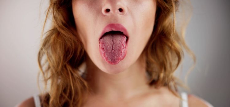 What is a Scalloped Tongue?