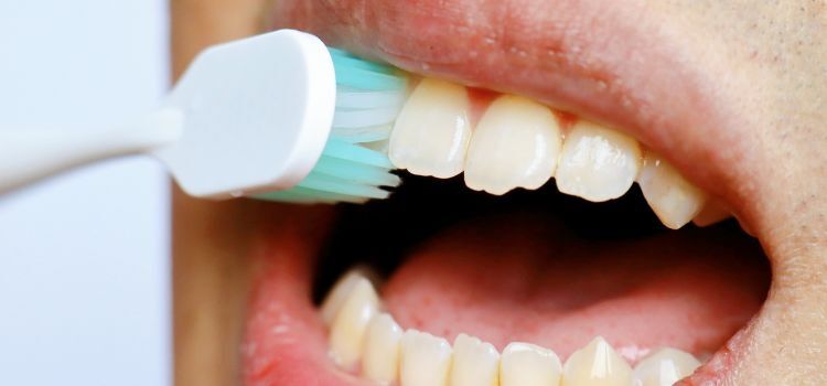 what is teeth attrition